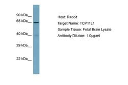 TCP11L1 Rabbit anti-Human, Polyclonal, Novus Biologicals 0.1 mL | Buy Online | Novus Biologicals | Fisher Scientific